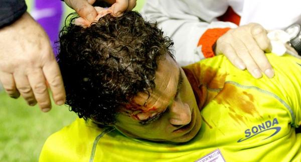 Sangue e suor: Martin Silva recebe atendimento depois de levar pedrada em jogo pela Sul-Americana de 2010