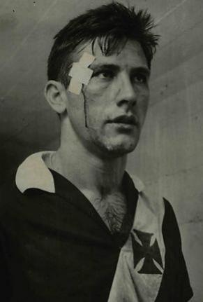 Bellini com machucado aps partida pelo Vasco em 1961