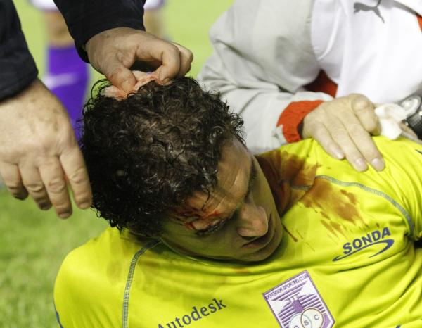 Martín Silva recebe atendimento após pedrada fazer ferida em sua cabeça contra o Independiente, na Argentina 