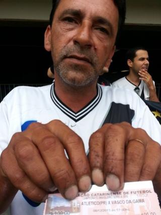 Com as mos arranhadas pelos caranguejos, Isomar exibe o ingresso para Atltico-PR x Vasco