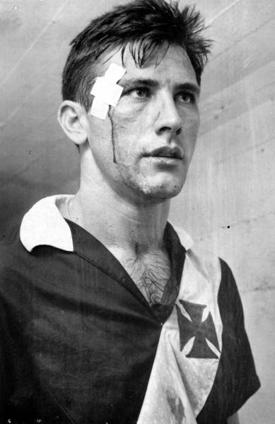 Verso original da foto de Bellini sangrando aps jogo