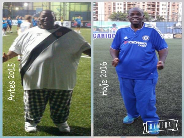 Bola j perdeu bastante peso aps a cirurgia baritrica realizada h pouco tempo