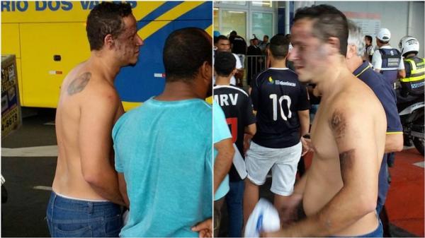 Sinalizador explode no rosto de torcedor na chegada do Vasco no Esprito Santo