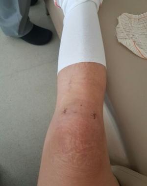 Srgio Sasaki operou o joelho direito